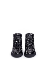 Front View -Click To Enlarge Marble print leather high top sneakers