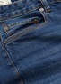 Detail View - Click To Enlarge - TOPMAN - Skinny jeans
