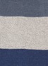 Detail View - Click To Enlarge - PAUL SMITH - 'Zebra stripe' socks