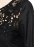 Detail View - Click To Enlarge - SEE BY CHLOÉ - Floral guipure lace insert cotton dress