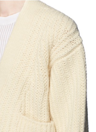 Detail View - Click To Enlarge - ACNE STUDIOS - 'Hadlee' chunky knit cardigan