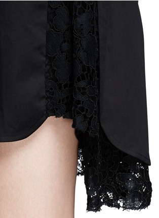 Detail View - Click To Enlarge - THAKOON - Hidden lace button down shirt dress