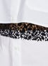 JW ANDERSON - Lace Insert Mini Shirt Dress