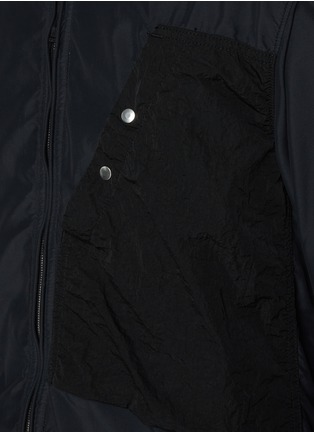  - STONE ISLAND - Zipped Overshirt