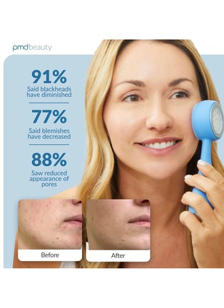  - PMD BEAUTY - PMD Clean Acne