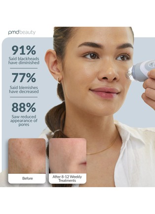 Detail View - Click To Enlarge - PMD BEAUTY - PMD Personal Microderm Elite Pro — London Fog Grey
