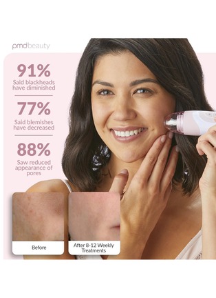 Detail View - Click To Enlarge - PMD BEAUTY - PMD Personal Microderm Elite Pro — Cherry Blossom Pink