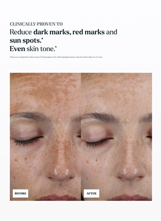 Detail View - Click To Enlarge - SKIN ROCKS - The Hyperpigmentation Serum 30ml