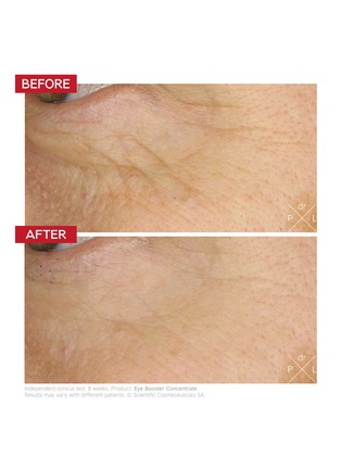Detail View - Click To Enlarge - DR. LEVY - The Eye Longevity Set