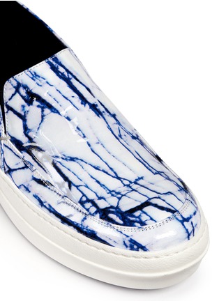 Detail View - Click To Enlarge - MC Q SHOES - 'Fields' Marble print leather skate slip-ons