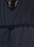 Detail View - Click To Enlarge - ALEXANDER WANG - Lace trim windbreaker slip dress