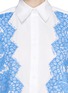 Detail View - Click To Enlarge - PREEN BY THORNTON BREGAZZI - 'Emerson' lace appliqué poplin shirt