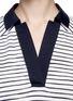 Detail View - Click To Enlarge - TORY BURCH - 'Dixie' stripe cotton polo tunic
