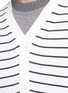 Detail View - Click To Enlarge - SACAI - Stripe bungee drawstring hem cardigan