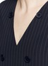 Detail View - Click To Enlarge - DKNY - Button front panel pinstripe shift dress