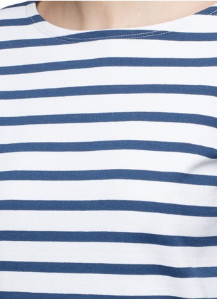 Detail View - Click To Enlarge - PORTS 1961 - Cutout lip print stripe cotton top