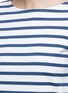 Detail View - Click To Enlarge - PORTS 1961 - Cutout lip print stripe cotton top