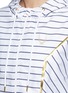 Detail View - Click To Enlarge - LUCAS HUGH - Pinstripe rainshell sports jacket