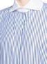 Detail View - Click To Enlarge - VICTORIA BECKHAM - Oversize candy stripe cotton poplin man shirt