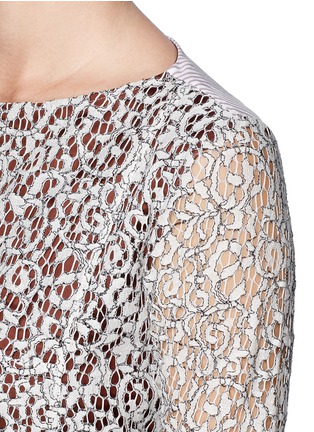 Detail View - Click To Enlarge - CARVEN - Stripe poplin back lace top