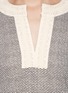 Detail View - Click To Enlarge - TORY BURCH - 'Selda' crochet trim linen tunic